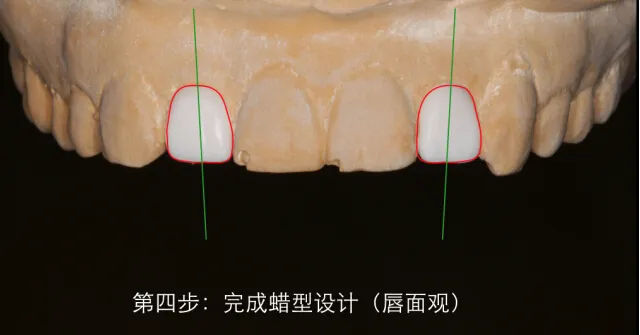 美学蜡型---简易操作理念
