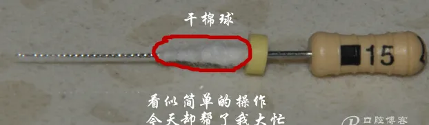 钢牙 烤瓷冠 不破冠确定工作长度(小方法) 钢牙 烤瓷冠 不破冠确定工作长度(小方法)