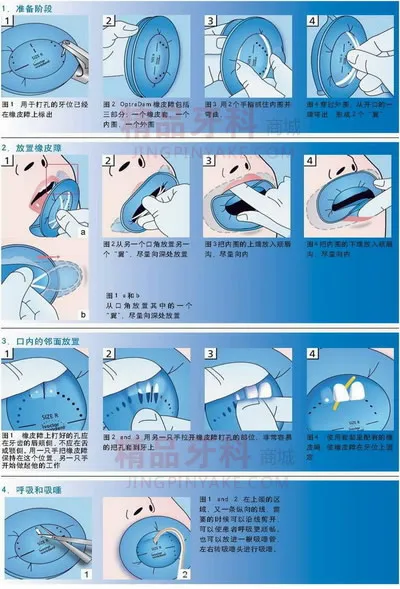 义获嘉 橡皮障 义获嘉 橡皮障